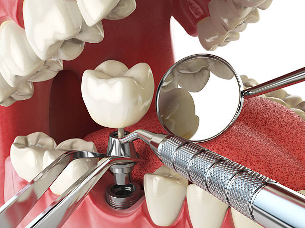 Best Emergency TMJ Treatment in Clinton, MS