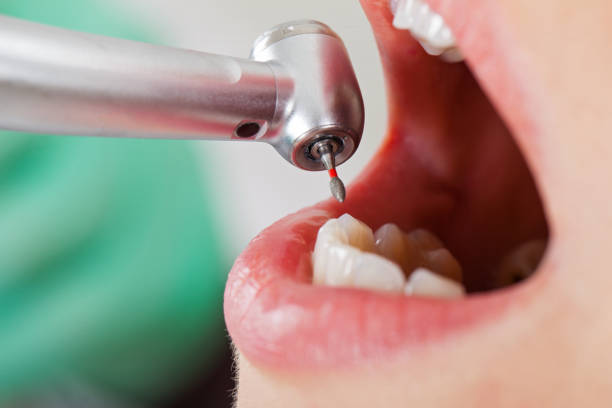 Best Pediatric Emergency Dentist in Clinton, MS